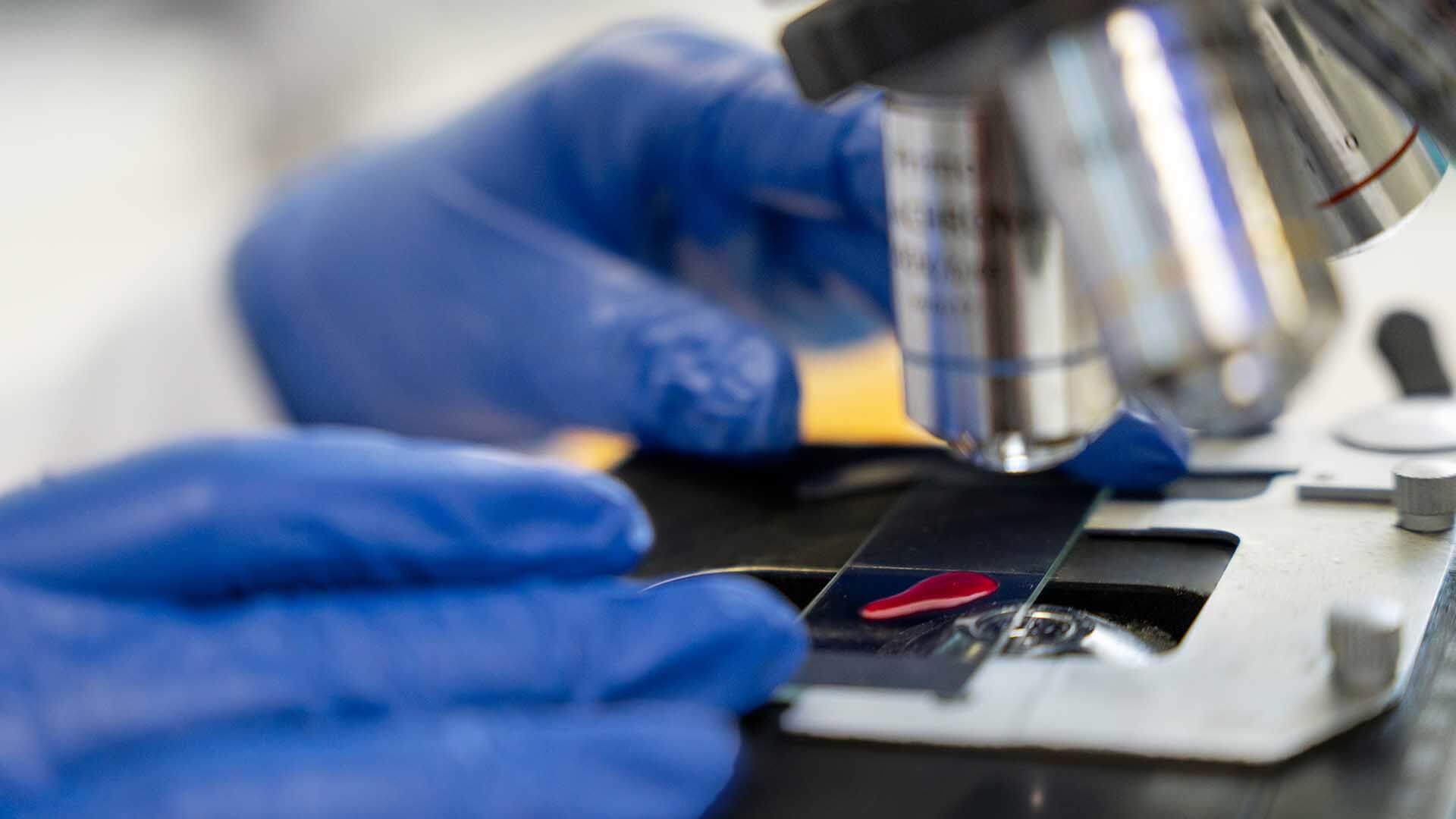 DNA in Criminal Sexual Conduct Cases